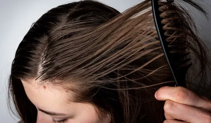 Oily Scalp: Why you have it and how to prevent it